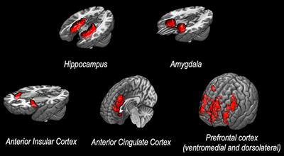 Neuroimaging Correlates of Resilience to Traumatic Events—A Comprehensive Review